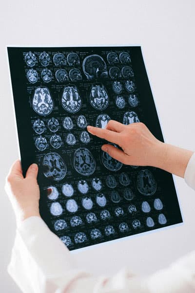 gnc-brainfunction_img Stem Cell